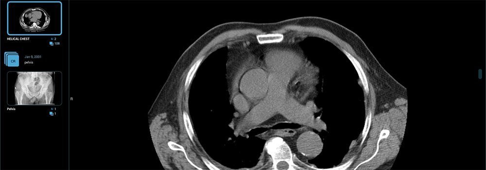 Medical-Images-Instead-of-DICOM-Storages-on-IcontentMart